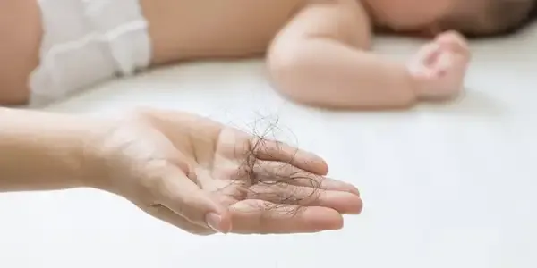 Rụng tóc sau sinh: nguyên nhân, dấu hiệu và cách điều trị